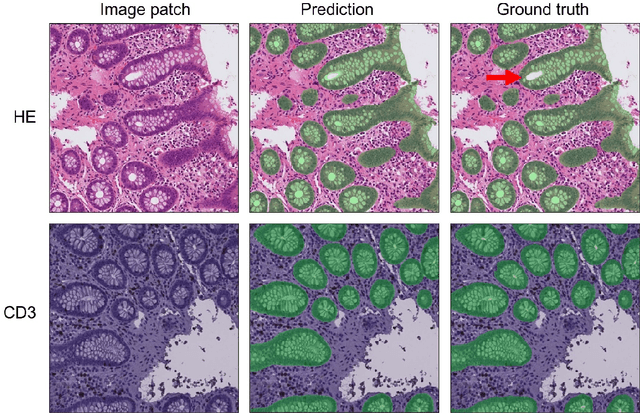 Figure 3 for Code-free development and deployment of deep segmentation models for digital pathology