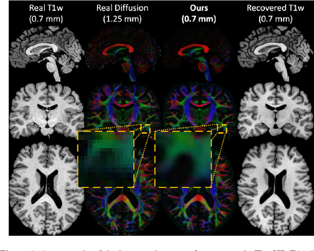 Figure 1 for Manifold-aware Synthesis of High-resolution Diffusion from Structural Imaging