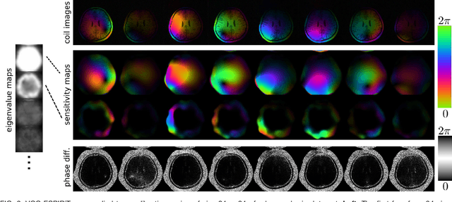 Figure 2 for Estimating Absolute-Phase Maps Using ESPIRiT and Virtual Conjugate Coils