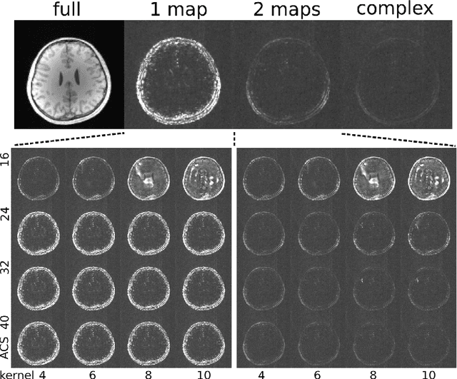 Figure 3 for Estimating Absolute-Phase Maps Using ESPIRiT and Virtual Conjugate Coils