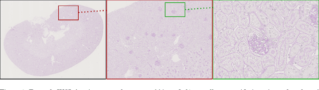 Figure 1 for CNN Cascades for Segmenting Whole Slide Images of the Kidney