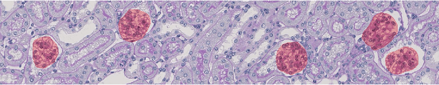Figure 3 for CNN Cascades for Segmenting Whole Slide Images of the Kidney