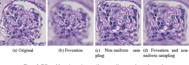 Figure 4 for CNN Cascades for Segmenting Whole Slide Images of the Kidney