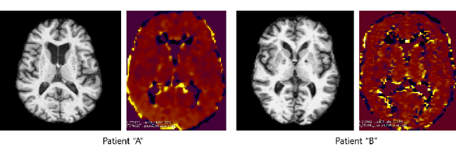 Figure 1 for GANBERT: Generative Adversarial Networks with Bidirectional Encoder Representations from Transformers for MRI to PET synthesis