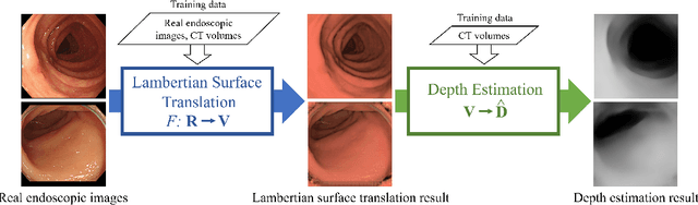Figure 1 for Depth Estimation from Single-shot Monocular Endoscope Image Using Image Domain Adaptation And Edge-Aware Depth Estimation
