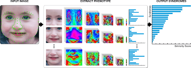 Figure 1 for DeepGestalt - Identifying Rare Genetic Syndromes Using Deep Learning