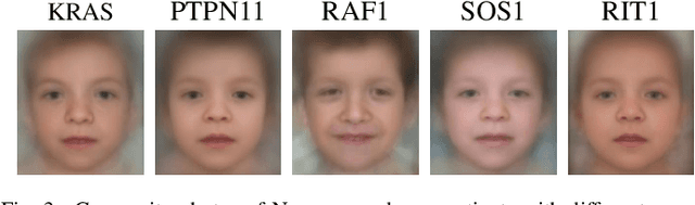 Figure 3 for DeepGestalt - Identifying Rare Genetic Syndromes Using Deep Learning