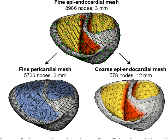 Figure 1 for Reducing Line-of-block Artifacts in Cardiac Activation Maps Estimated Using ECG Imaging: A Comparison of Source Models and Estimation Methods