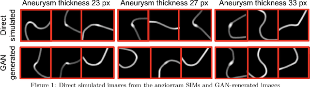 Figure 1 for Evaluating Procedures for Establishing Generative Adversarial Network-based Stochastic Image Models in Medical Imaging