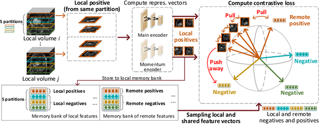 Figure 3 for Federated Contrastive Learning for Volumetric Medical Image Segmentation
