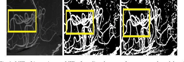 Figure 4 for DS6: Deformation-aware learning for small vessel segmentation with small, imperfectly labeled dataset