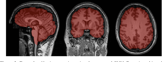 Figure 4 for Training of a Skull-Stripping Neural Network with efficient data augmentation