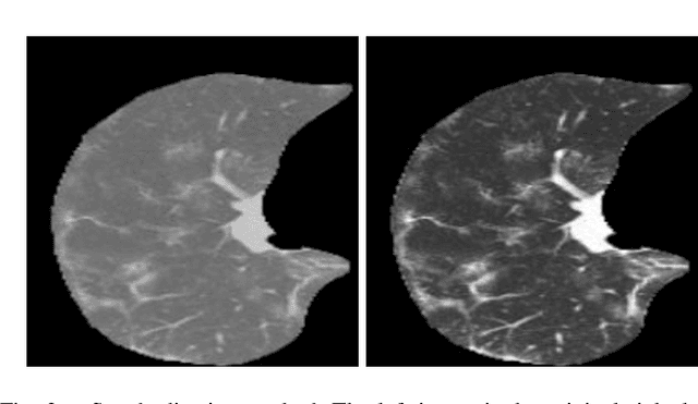 Figure 3 for CNN Filter Learning from Drawn Markers for the Detection of Suggestive Signs of COVID-19 in CT Images