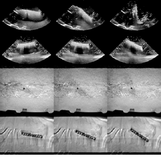 Figure 2 for Mechanically Powered Motion Imaging Phantoms: Proof of Concept