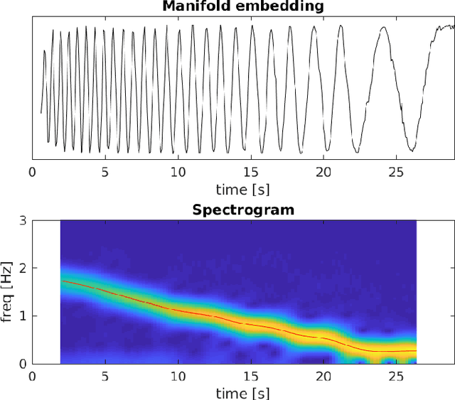 Figure 3 for Mechanically Powered Motion Imaging Phantoms: Proof of Concept
