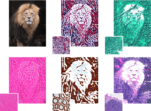 Figure 1 for Gram Barcodes for Histopathology Tissue Texture Retrieval