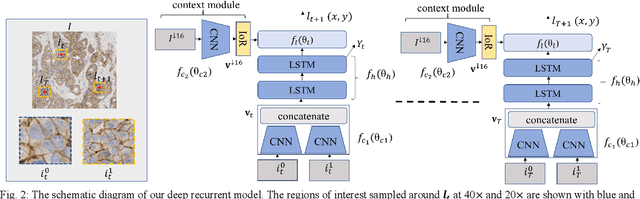 Figure 2 for Learning Where to See: A Novel Attention Model for Automated Immunohistochemical Scoring