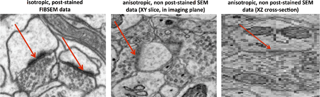 Figure 1 for VESICLE: Volumetric Evaluation of Synaptic Interfaces using Computer vision at Large Scale