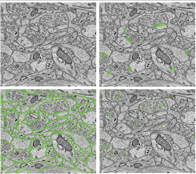 Figure 3 for VESICLE: Volumetric Evaluation of Synaptic Interfaces using Computer vision at Large Scale