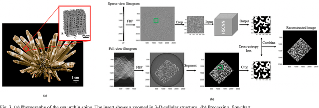 Figure 3 for Robust X-ray Sparse-view Phase Tomography via Hierarchical Synthesis Convolutional Neural Networks