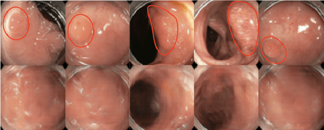 Figure 1 for Photoshopping Colonoscopy Video Frames