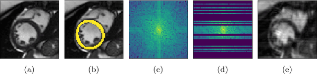 Figure 4 for Explicit topological priors for deep-learning based image segmentation using persistent homology