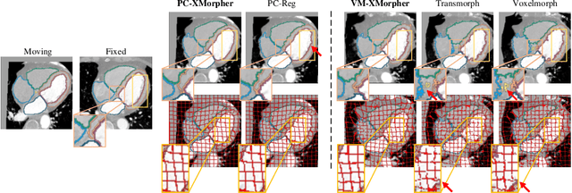Figure 4 for XMorpher: Full Transformer for Deformable Medical Image Registration via Cross Attention