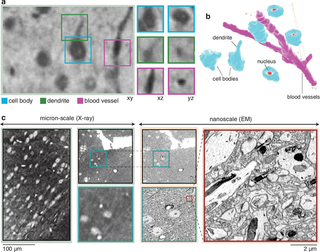 Figure 3 for Quantifying mesoscale neuroanatomy using X-ray microtomography