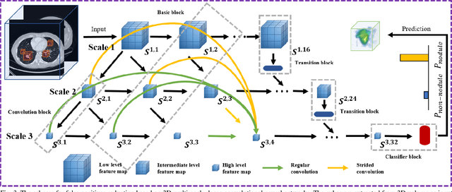 Figure 3 for Efficient convolutional neural networks for multi-planar lung nodule detection: improvement on small nodule identification