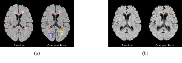 Figure 1 for Counterfactual Image Synthesis for Discovery of Personalized Predictive Image Markers