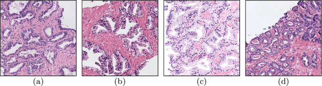 Figure 1 for Prostate Gland Segmentation in Histology Images via Residual and Multi-Resolution U-Net
