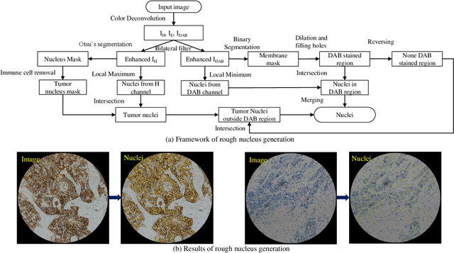 Figure 4 for Microscope Based HER2 Scoring System