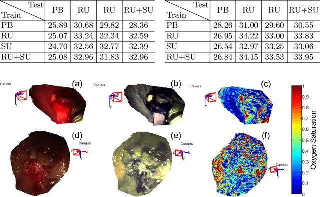 Figure 4 for Endoscopic Depth Measurement and Super-Spectral-Resolution Imaging