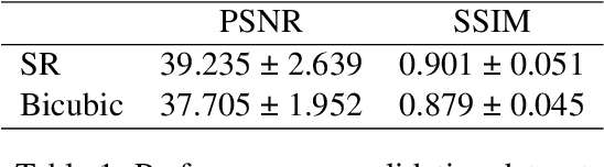 Figure 2 for Recurrent Super-Resolution Method for Enhancing Low Quality Thermal Facial Data