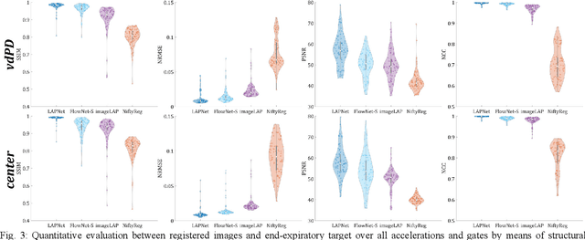 Figure 3 for LAPNet: Non-rigid Registration derived in k-space for Magnetic Resonance Imaging