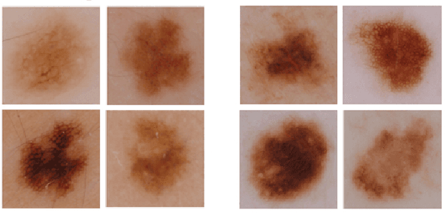 Figure 1 for Class-dependent Compression of Deep Neural Networks