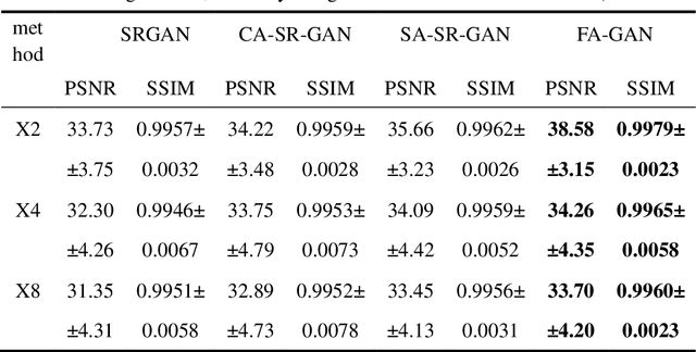 Figure 2 for FA-GAN: Fused Attentive Generative Adversarial Networks for MRI Image Super-Resolution