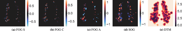 Figure 1 for Geometric Loss for Deep Multiple Sclerosis lesion Segmentation