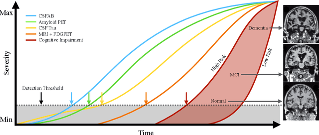 Figure 1 for DeepAD: A Robust Deep Learning Model of Alzheimer's Disease Progression for Real-World Clinical Applications