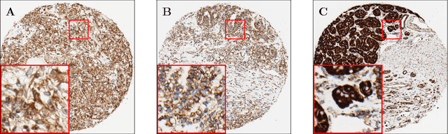 Figure 2 for Mitochondria-based Renal Cell Carcinoma Subtyping: Learning from Deep vs. Flat Feature Representations