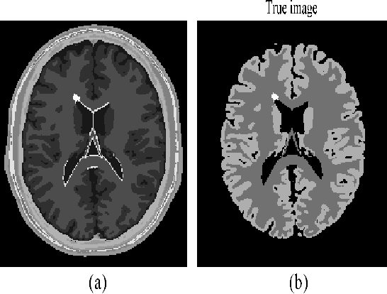Figure 2 for PET Image Reconstruction with Multiple Kernels and Multiple Kernel Space Regularizers