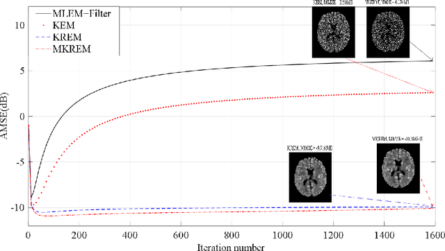 Figure 1 for PET Image Reconstruction with Multiple Kernels and Multiple Kernel Space Regularizers