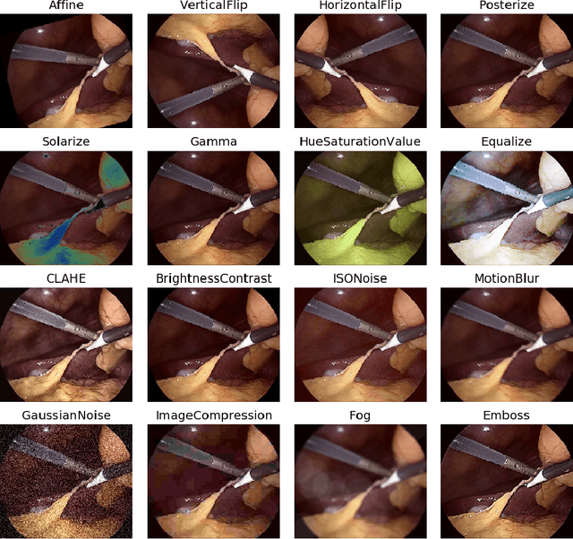 Figure 2 for Endo-Sim2Real: Consistency learning-based domain adaptation for instrument segmentation