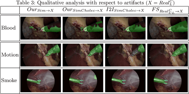 Figure 3 for Endo-Sim2Real: Consistency learning-based domain adaptation for instrument segmentation