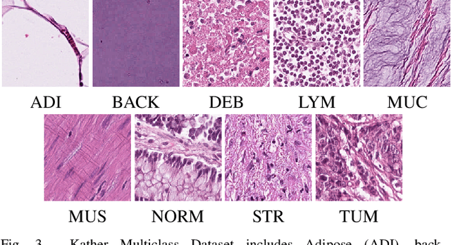 Figure 3 for PDBL: Improving Histopathological Tissue Classification with Plug-and-Play Pyramidal Deep-Broad Learning