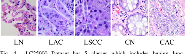 Figure 4 for PDBL: Improving Histopathological Tissue Classification with Plug-and-Play Pyramidal Deep-Broad Learning