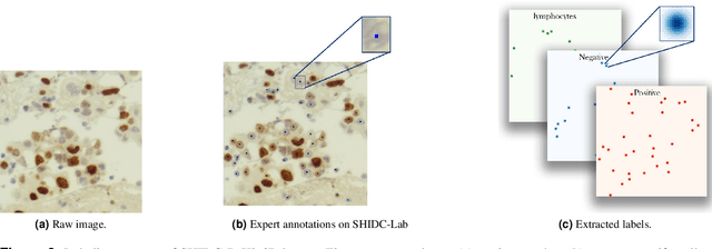 Figure 3 for PathoNet: Deep learning assisted evaluation of Ki-67 and tumor infiltrating lymphocytes (TILs) as prognostic factors in breast cancer; A large dataset and baseline