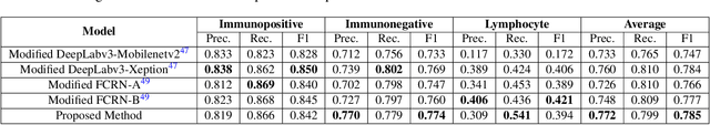 Figure 4 for PathoNet: Deep learning assisted evaluation of Ki-67 and tumor infiltrating lymphocytes (TILs) as prognostic factors in breast cancer; A large dataset and baseline