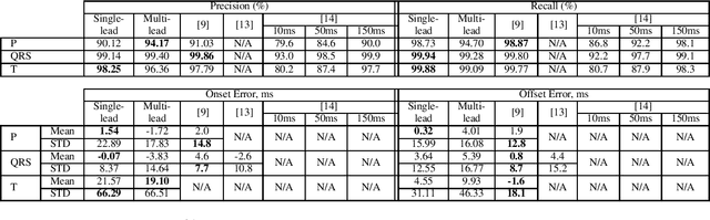 Figure 4 for ECG-DelNet: Delineation of Ambulatory Electrocardiograms with Mixed Quality Labeling Using Neural Networks