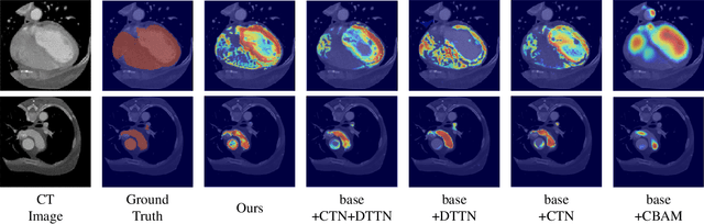 Figure 3 for Cardiac Segmentation on CT Images through Shape-Aware Contour Attentions